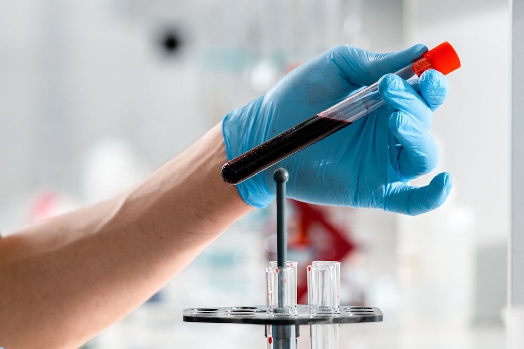 Navarra aplica la IA a la medicina transfusional